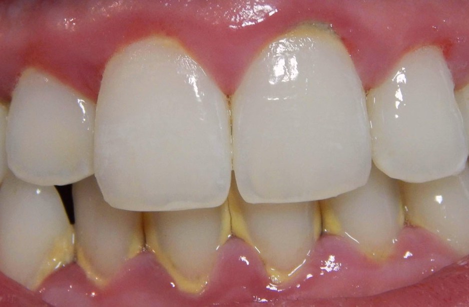 Periodontologia Gryfino